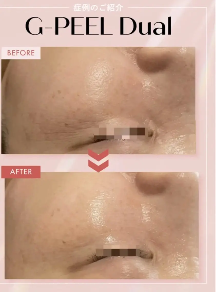 メンズ エステ リラク beauty salonnのエステ・リラクイメージ