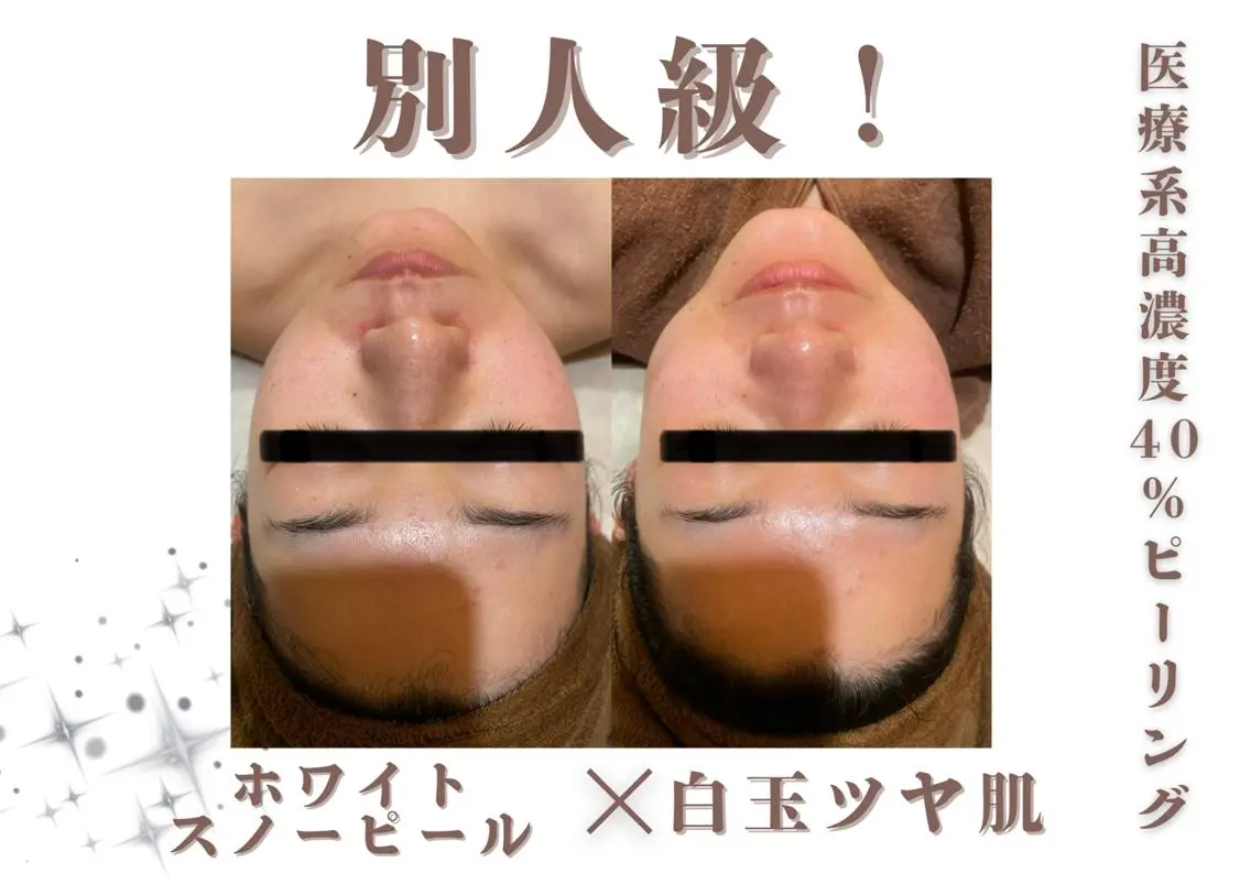 脱毛 🌷U24特別サロン レイビス銀座店🌷のエステ・リラクイメージ