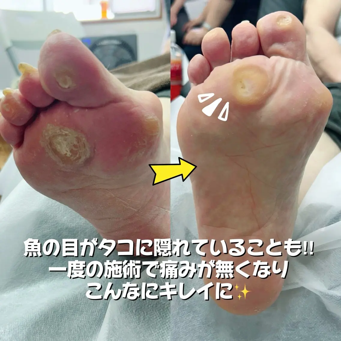 その他 フットケアサロン Kotoriのその他イメージ