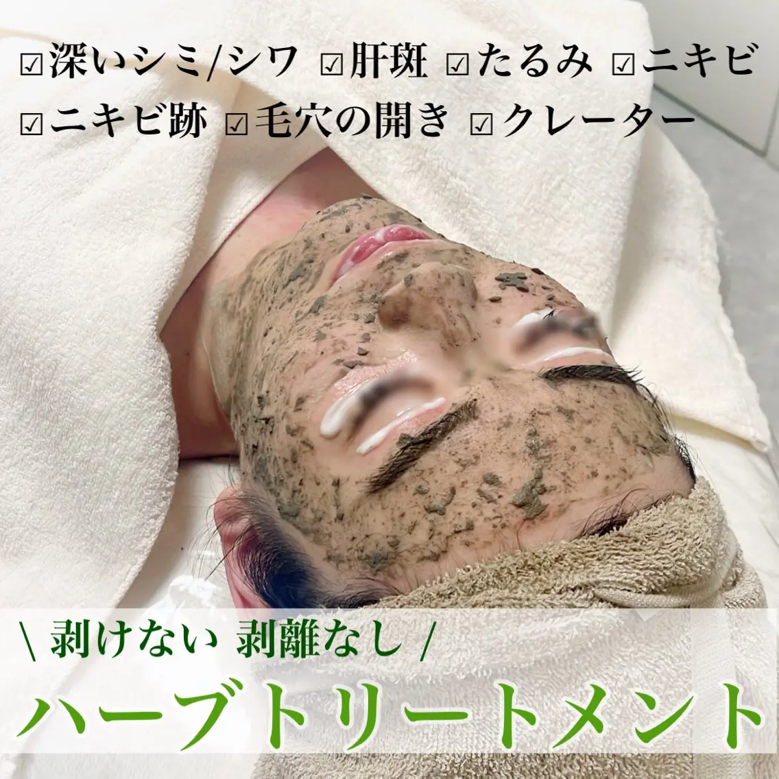 🌿‬話題の剥けない‬ハーブピーリング‬【2g】整顔マッサージ付🌿‬シミ・シワ/たるみ/ニキビ/肌質改善の写真