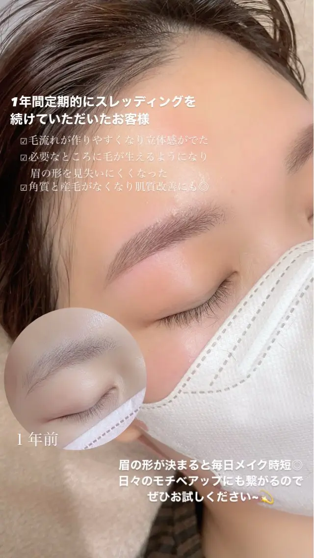 平日13-16限定 顔脱毛の写真
