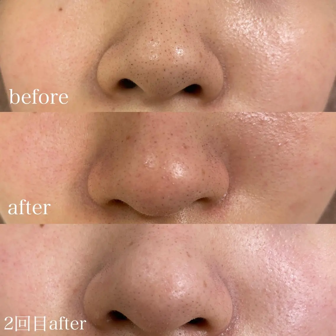 mish eyebrowのエステ・リラクイメージ