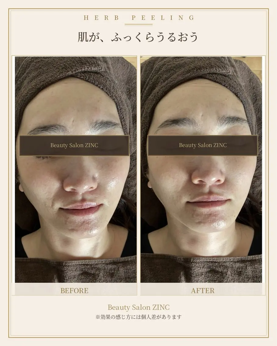 エステ 寺本 恵美のエステ・リラクイメージ