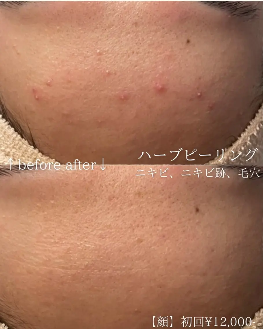 エステ 毛穴改善サロン d'Alba大阪住吉のエステ・リラクイメージ