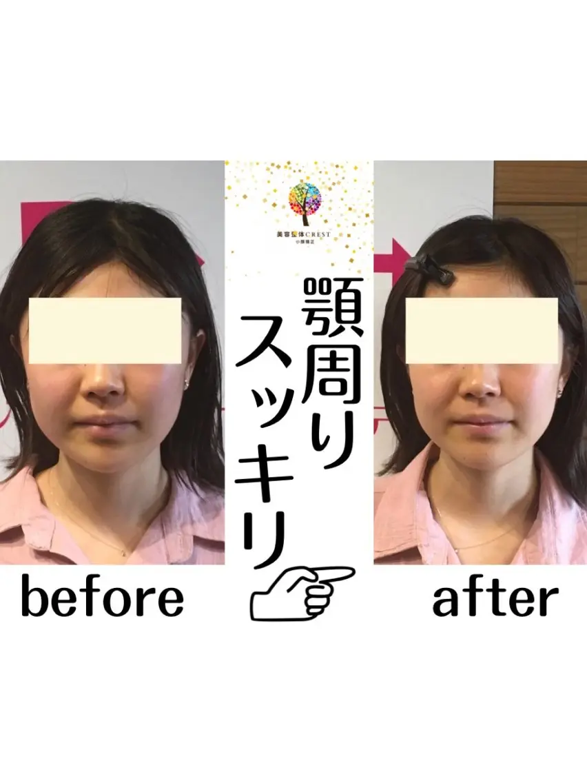 美容整体.小顔矯正 CREST佐藤大雅のエステ・リラクイメージ