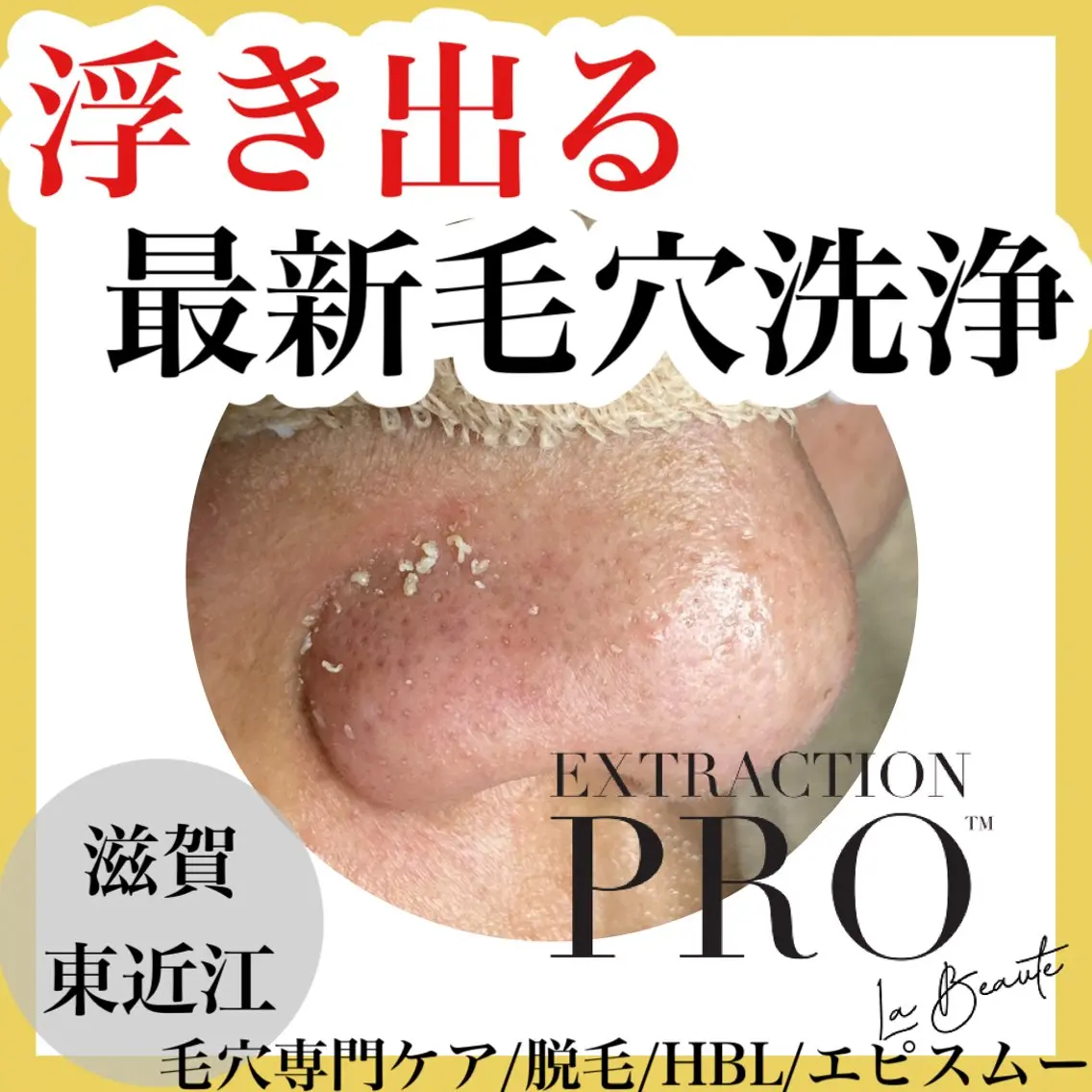 epismoo 脱毛/HBL/毛穴の眉毛・アイブロウイメージ