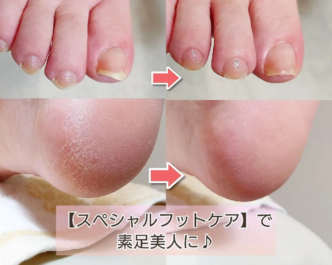 ネイル フットネイル improve /mamiのネイルデザイン