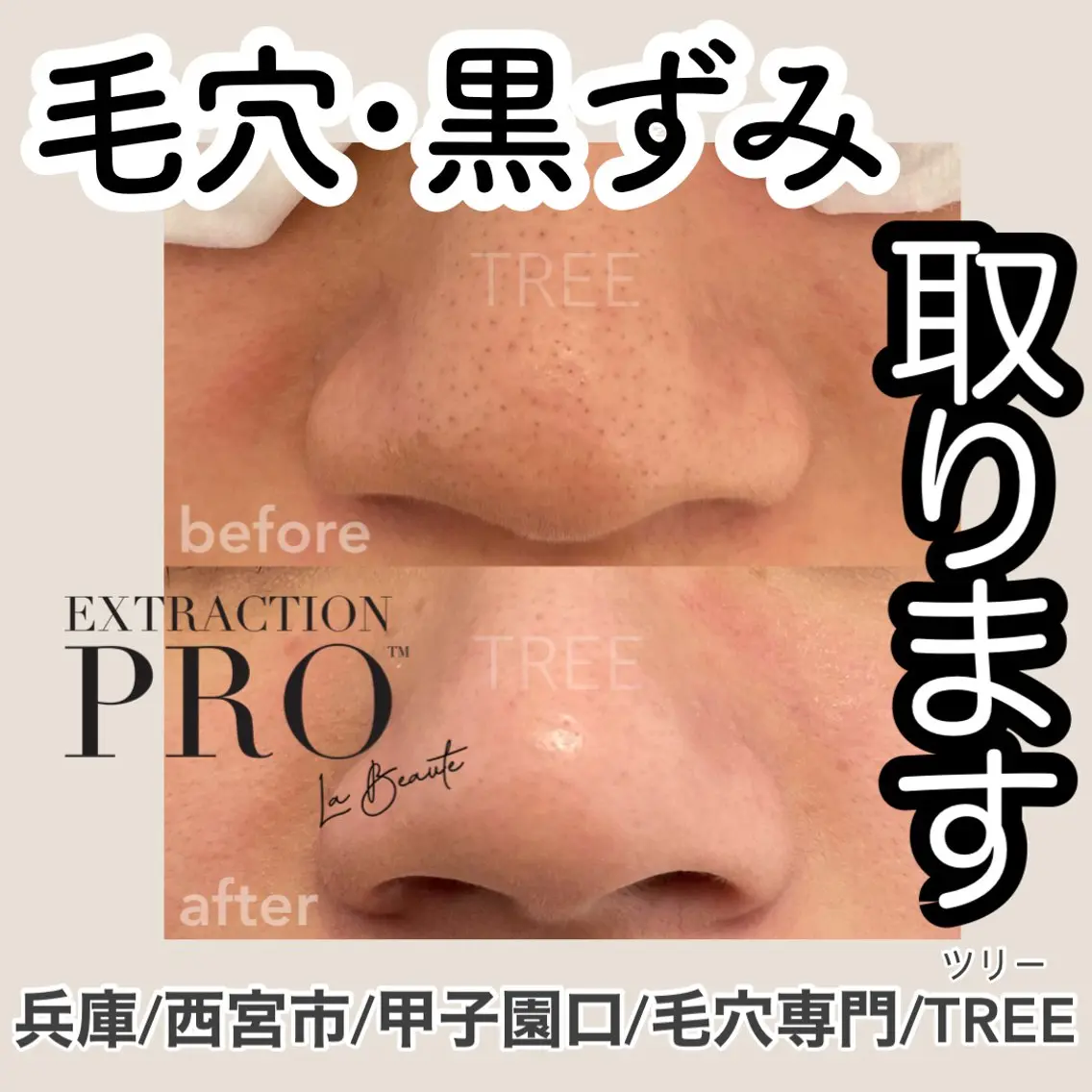 まつげ、毛穴 TREEのエステ・リラクイメージ