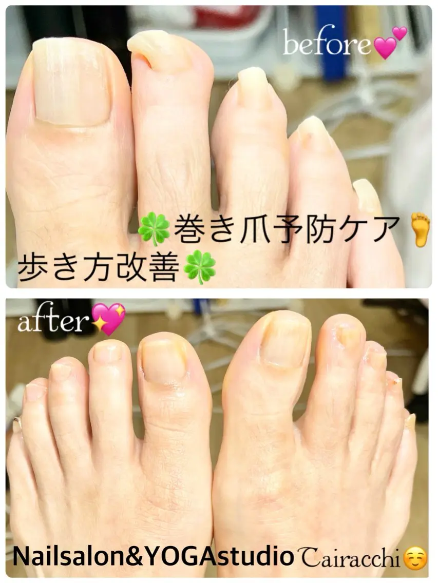 ネイル フットネイル Tairacchi タイラッチのネイルデザイン