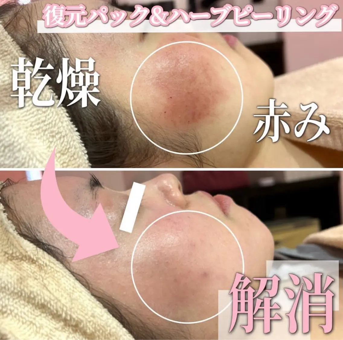 エステ SALON韓国肌管理 東別院のエステ・リラクイメージ