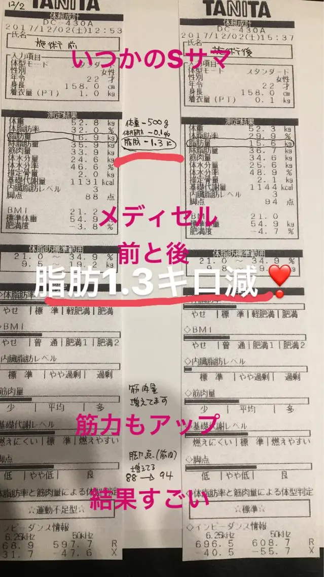 ［新規様限定］引き締めメディセル半身(30分)二回付.耳つぼ一回付キャンペーン！の写真