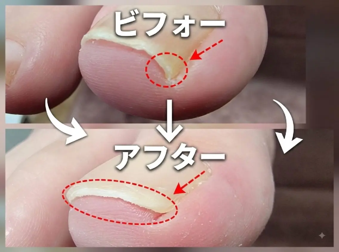 ネイル&巻き爪サロン AKnailのネイルデザイン
