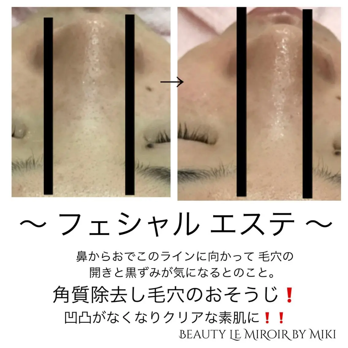 ビューティー ミロワールのエステ・リラクイメージ