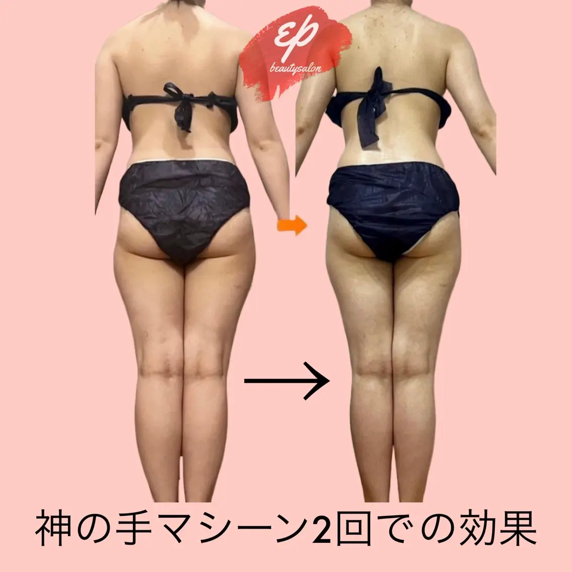 beauty salon epのエステ・リラクイメージ