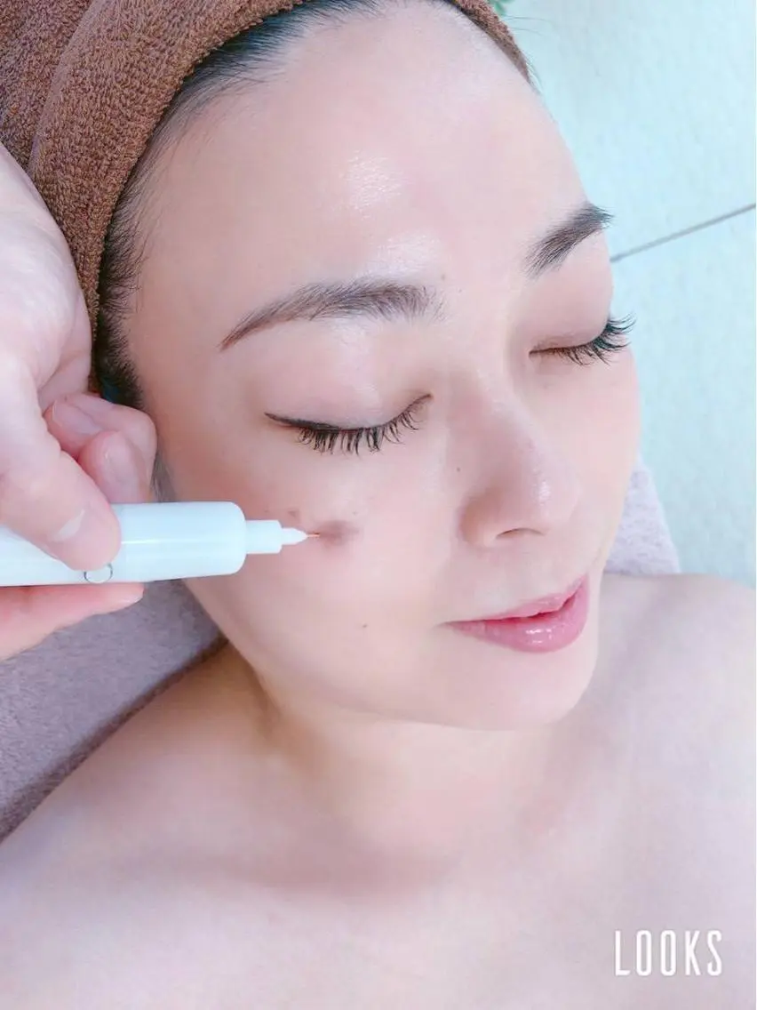 【シミケア体験】角質毛穴洗浄+シミケア10分し放題+肌代謝促進パック¥5000の写真