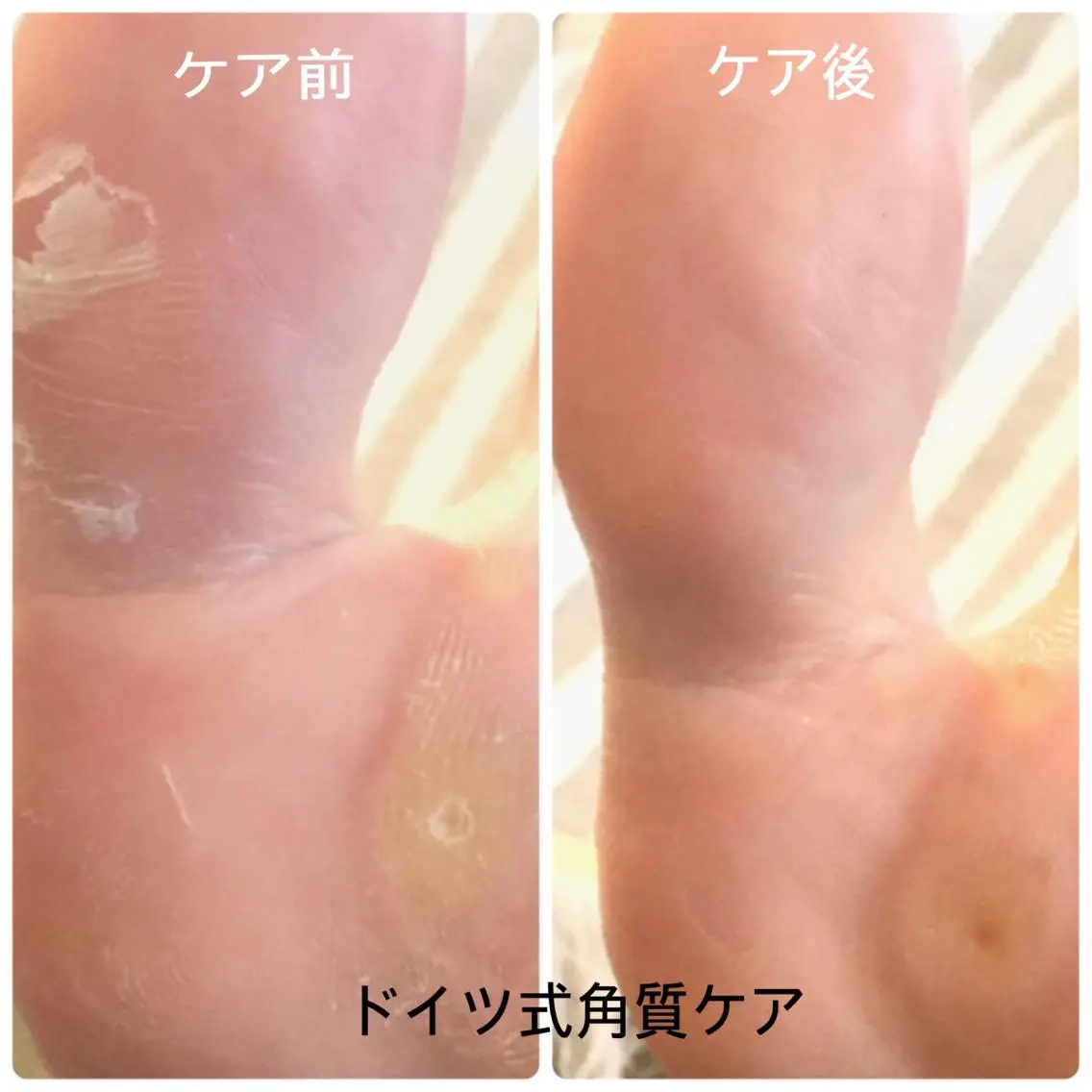 ネイル &nudgenail 本多のネイルデザイン