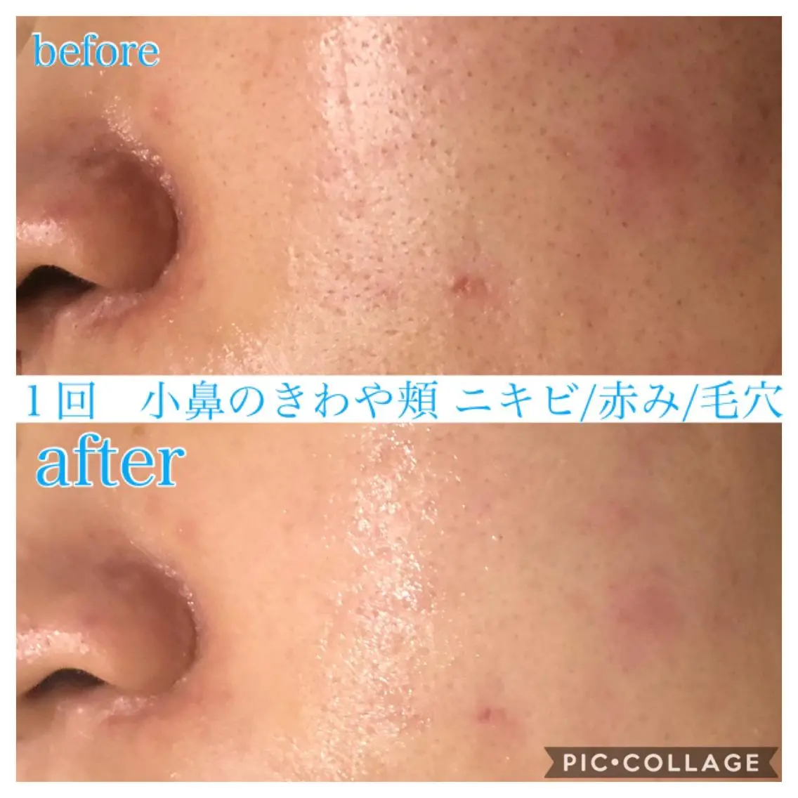 ミディアム カラー パーマ ヘアアレンジ メンズ エステ リラク EnsorClair 代表 野口真央のエステ・リラクイメージ