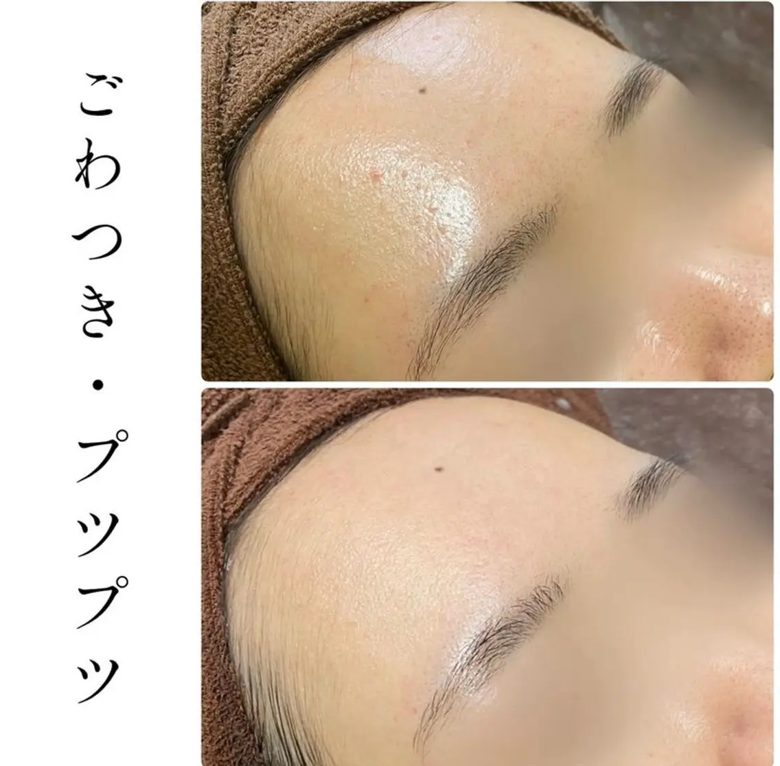 エステ ハーブピーリング専門 BIOPLUS+川崎のエステ・リラクイメージ