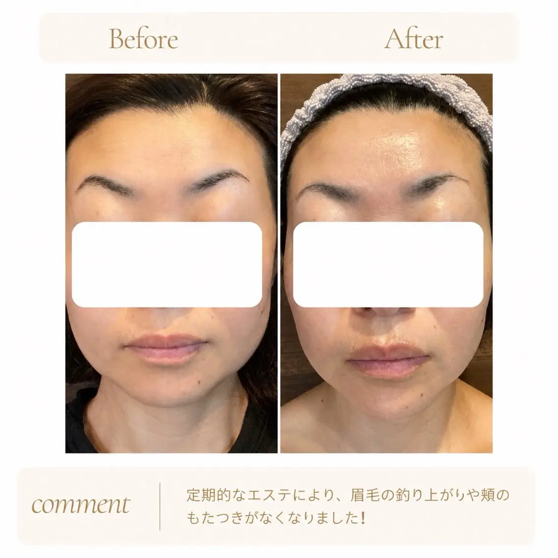 エステ SR SALON Michiのエステ・リラクイメージ