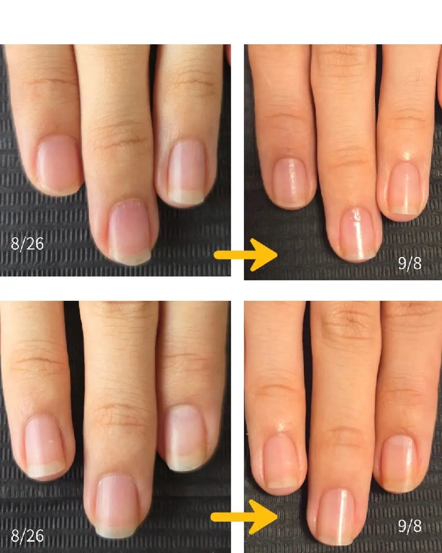 ネイル hana.nail 自爪育成サロンのネイルデザイン