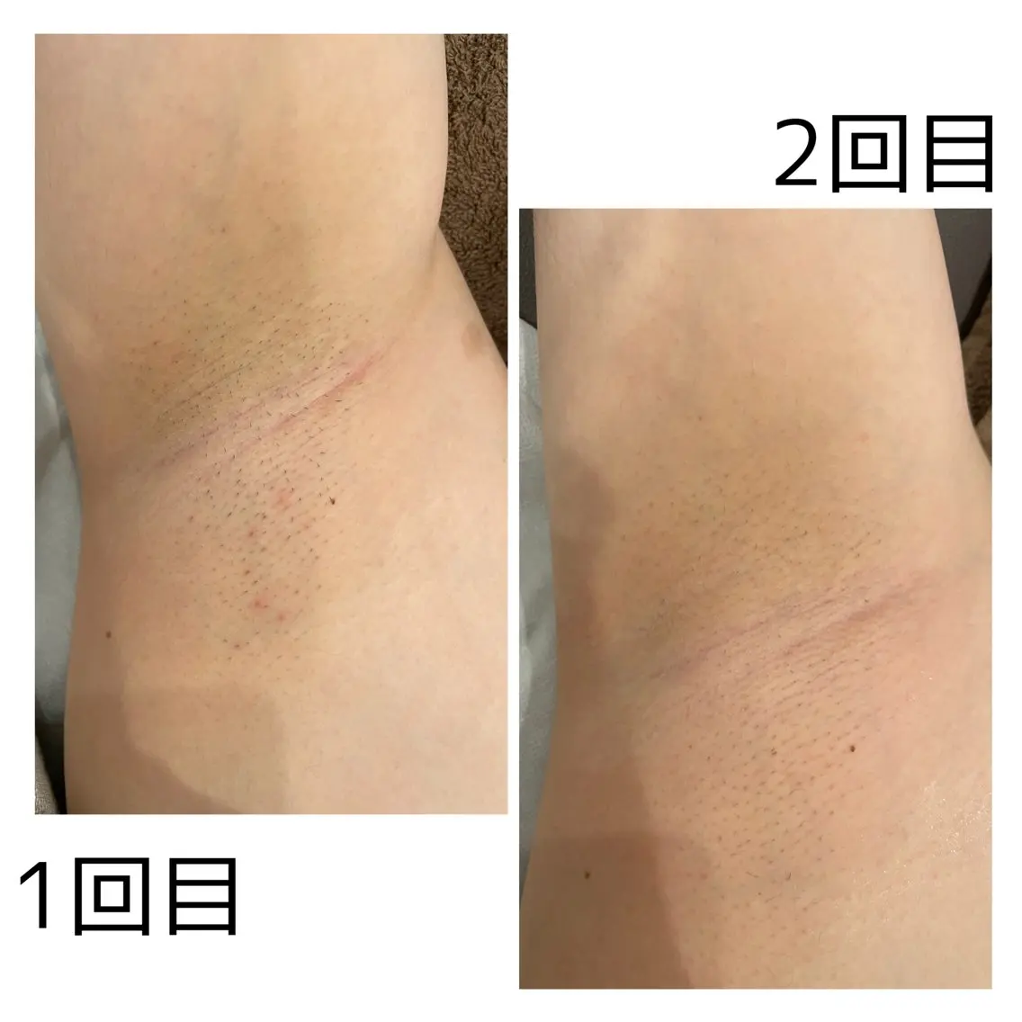 Linoa calm SANAのエステ・リラクイメージ