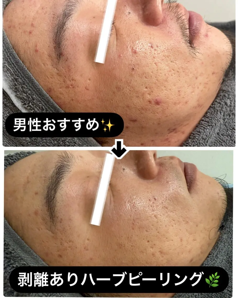 エステ 横田 汐里のネイルデザイン