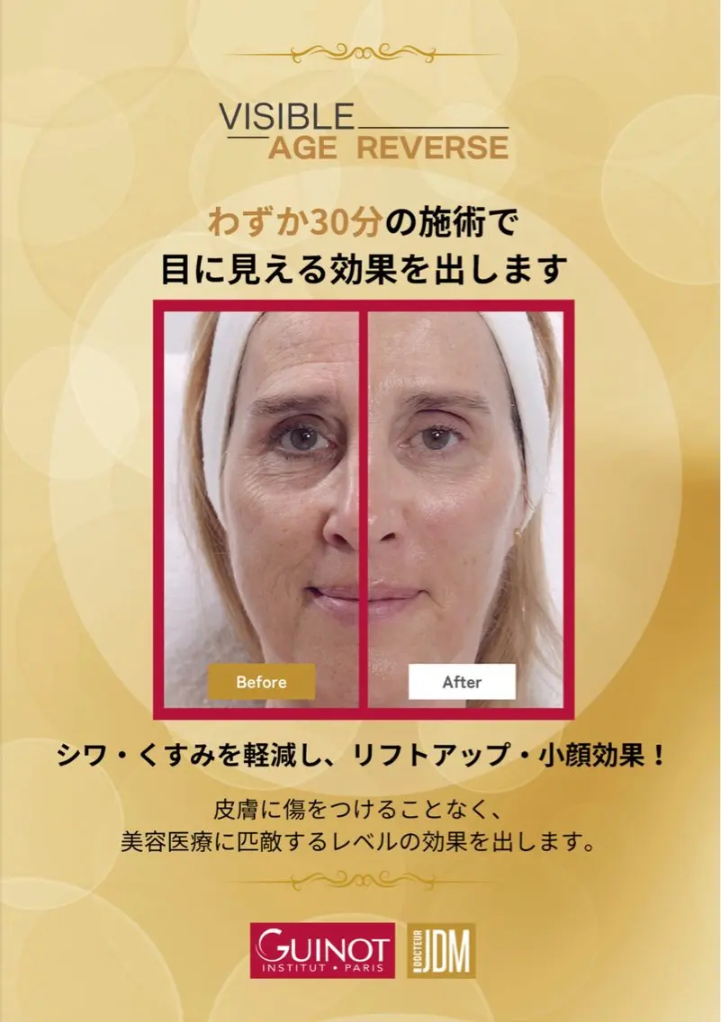【リピート率90%】ヨーロッパNo.1🇫🇷ギノーVAR [たるみ毛穴・たるみ・シワ・ほうれい線・リフトアップ]の写真