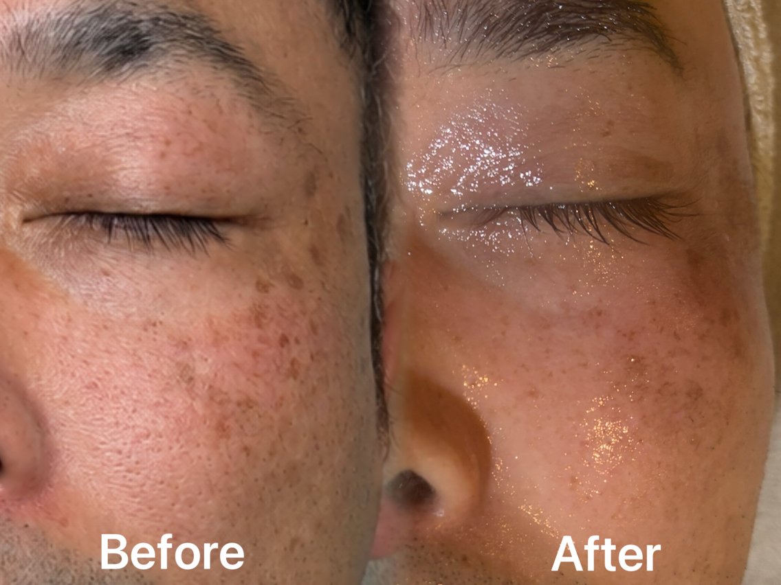 エステ リラク facial salon D 吉沢のエステ・リラクイメージ