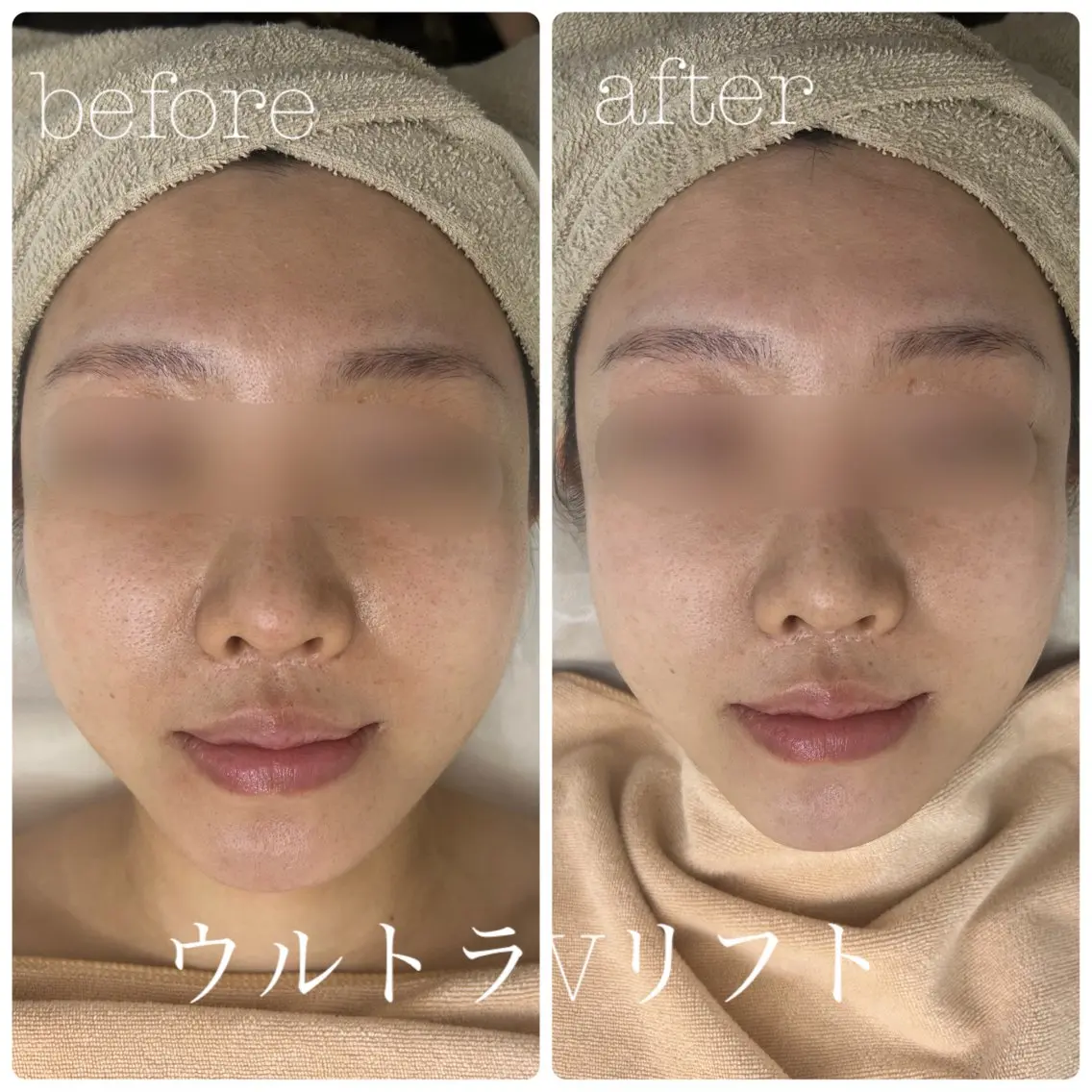 エステ フェイシャルサロン CHIARA 荒田のエステ・リラクイメージ