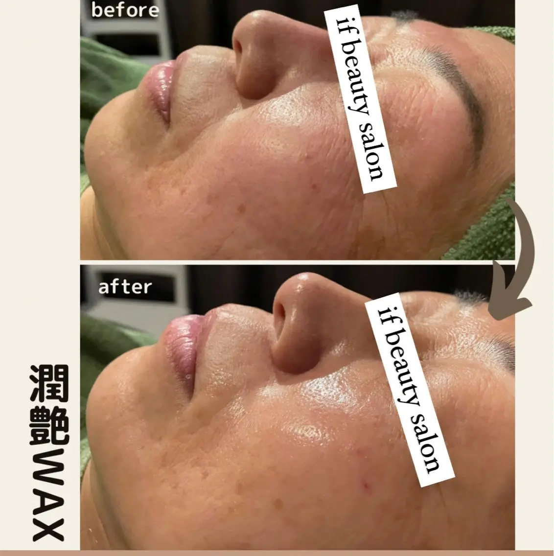 【毛穴・たるみ・くすみ・シワ解消究極の組み合わせ】潤艶WAX炭酸ガスパック仕上げ。ヘッドスパ付きの写真