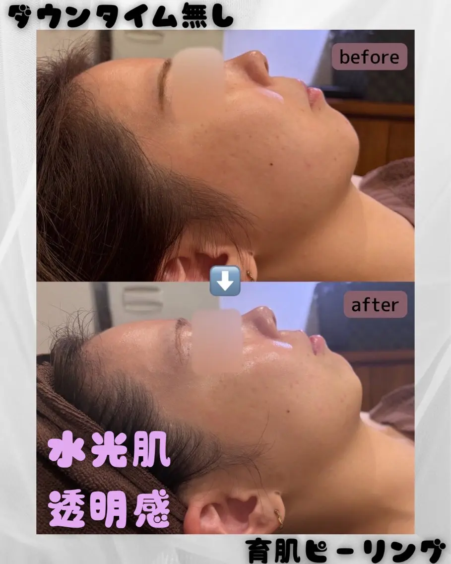 痩身｜美肌サロン 上西のエステ・リラクイメージ