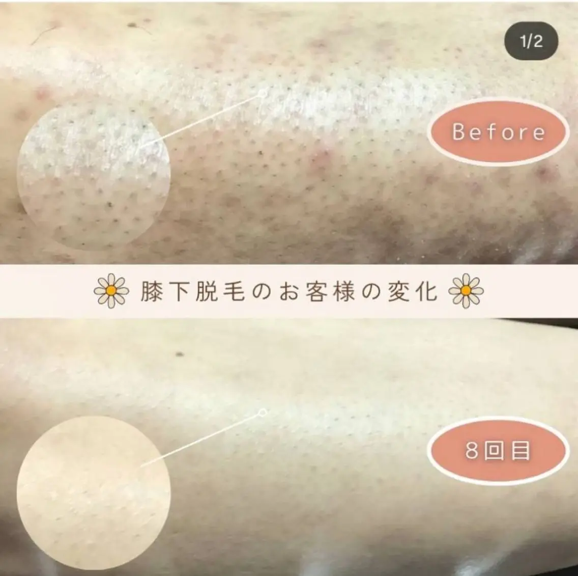 メンズ脱毛サロン リムーブのエステ・リラクイメージ