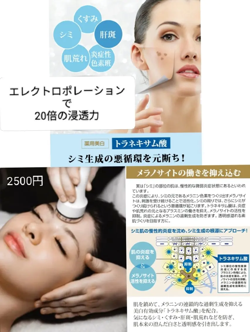 NEW✨トラネキサム酸✨エレクトロポレーション導入の写真