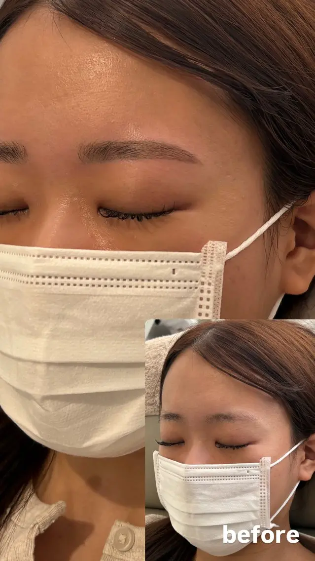 HBL毛流れ改善（美眉スタイリング・ワックス）　　　　　　　💫撮影モデル募集の写真