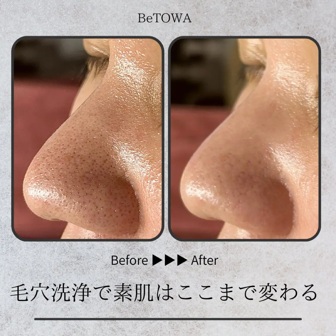エステ BeTOWA 毛穴洗浄/Wax脱毛のエステ・リラクイメージ