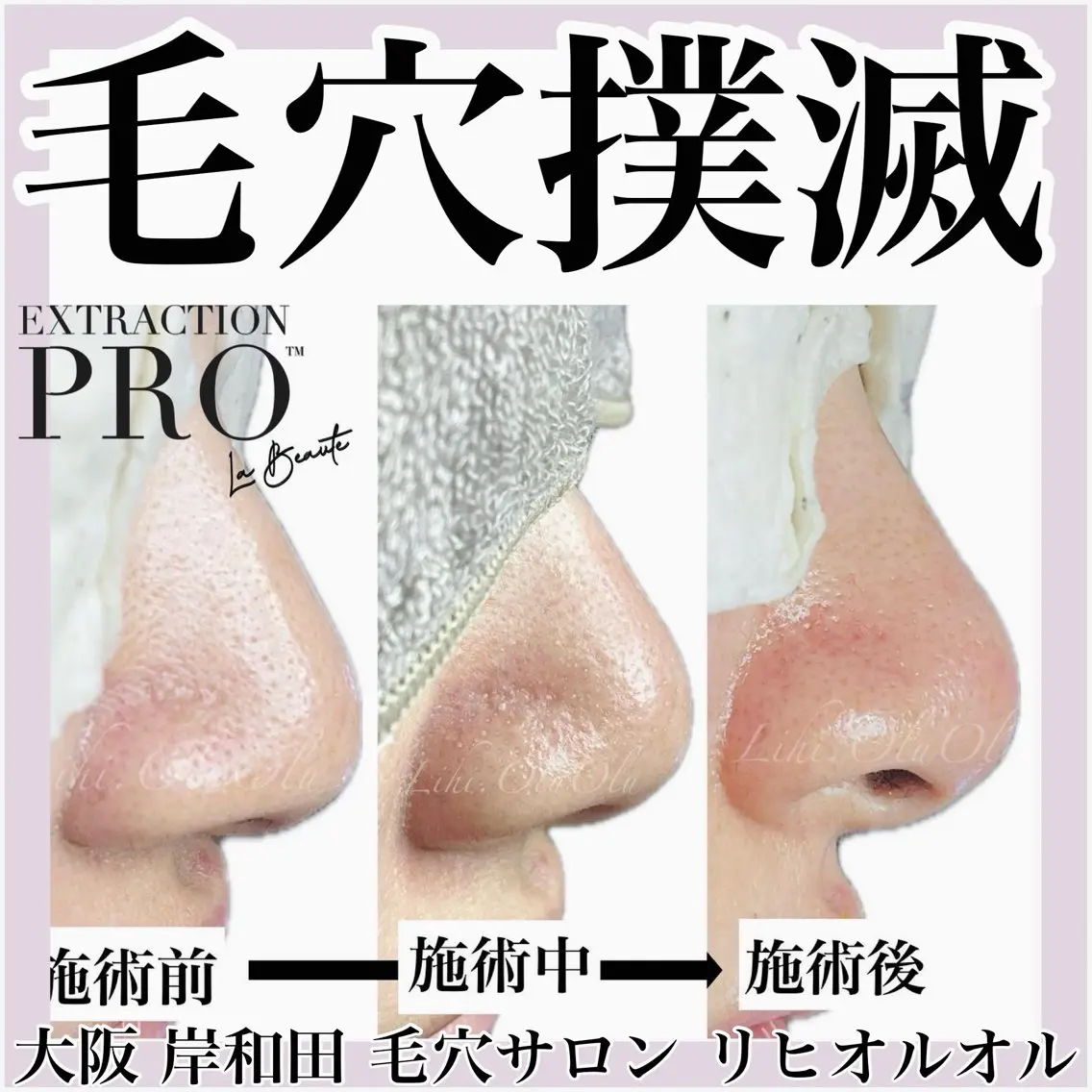 毛穴汚れ改善専門店/ 岸和田/リヒオルオルのエステ・リラクイメージ