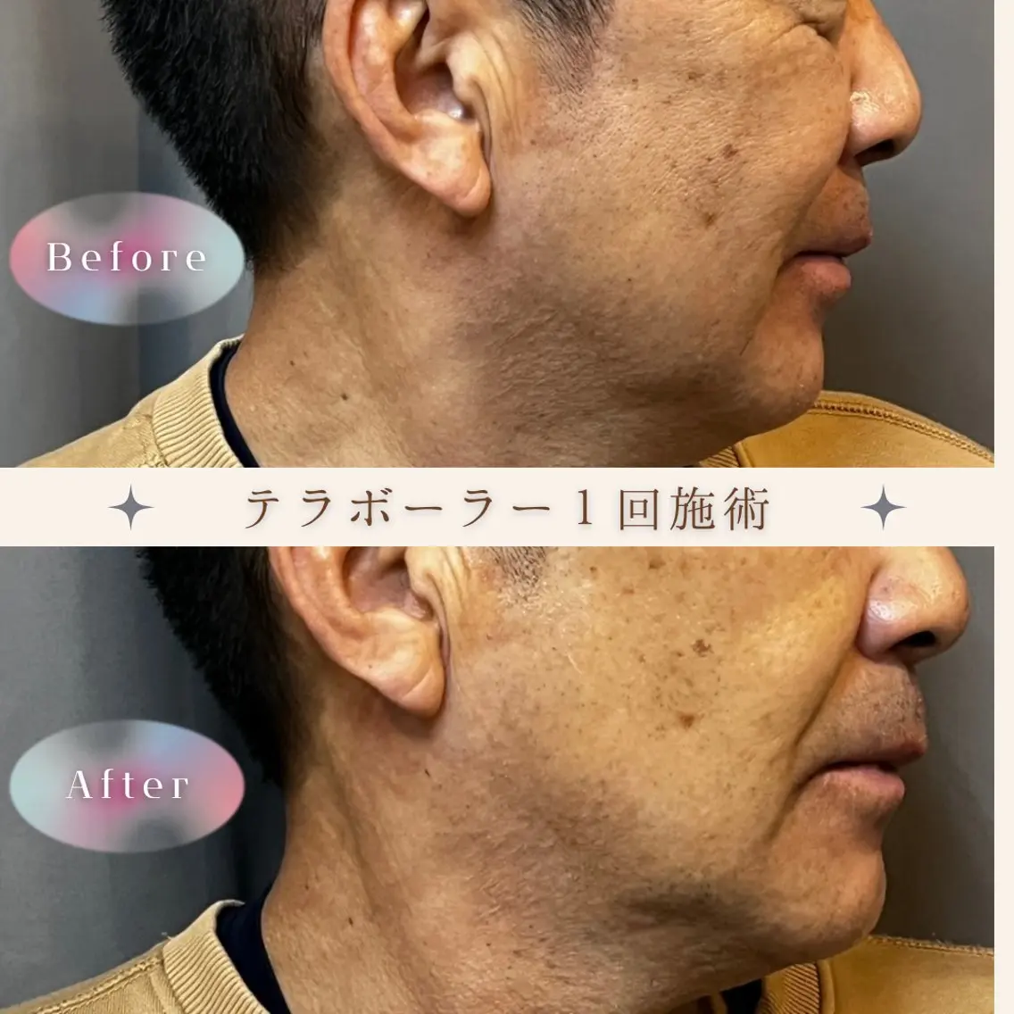 テラボーラー【モニター様募集】の写真