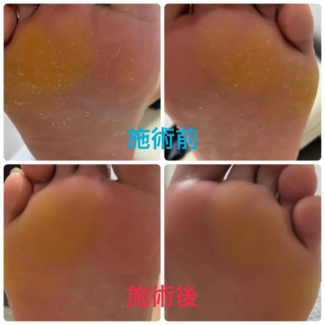 ネイル フットネイル フットネイル Nailsalon Bleu vertのネイルデザイン