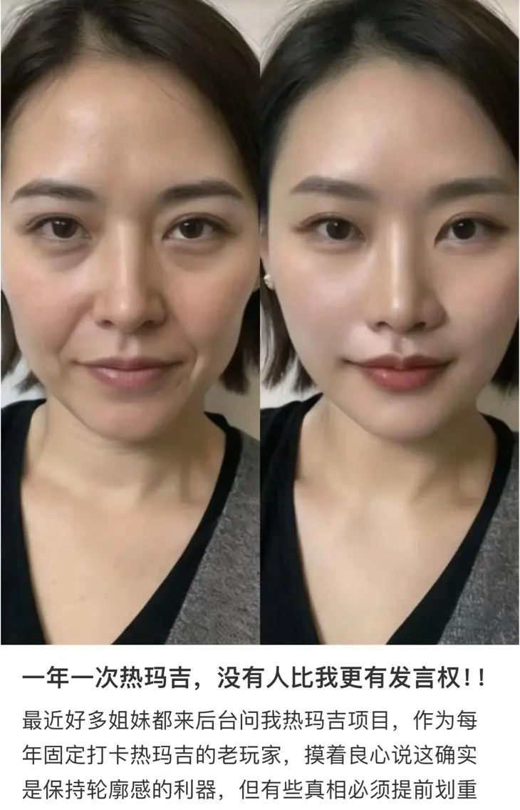 ネイル 愛維美水光専門店 川崎彩鳳のエステ・リラクイメージ