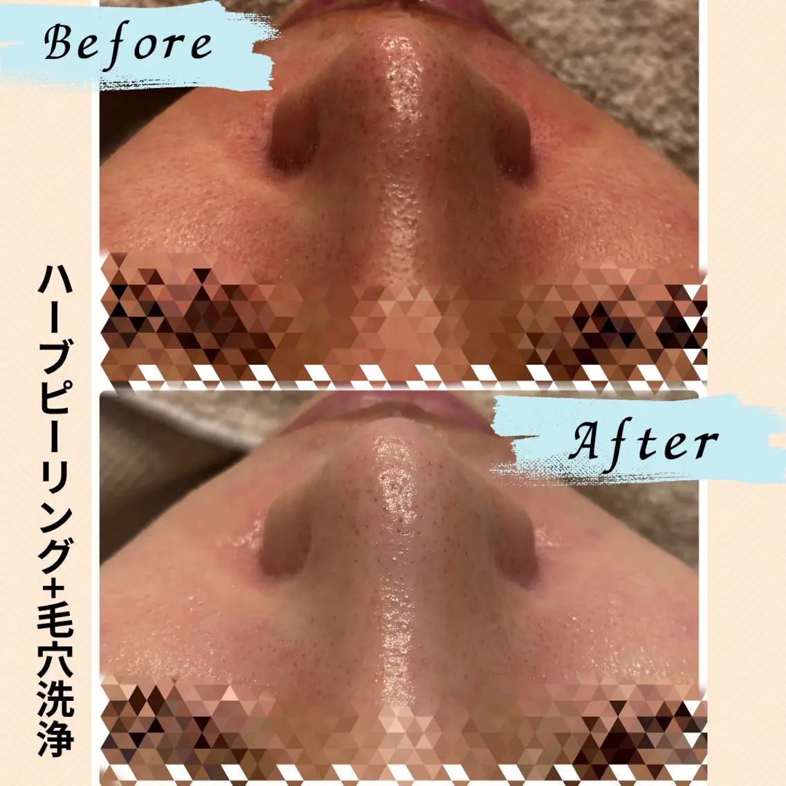 エステ 美肌管理専門Wax/ muroのエステ・リラクイメージ