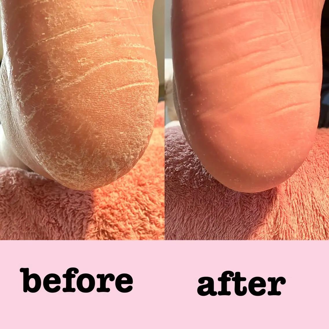 フットネイル NAIL DOLCEのネイルデザイン