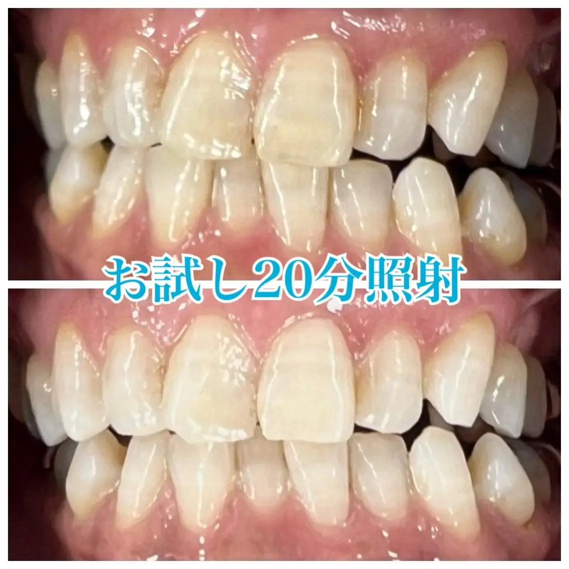 ホワイトニング🦷 ネイル💅LEAのその他イメージ