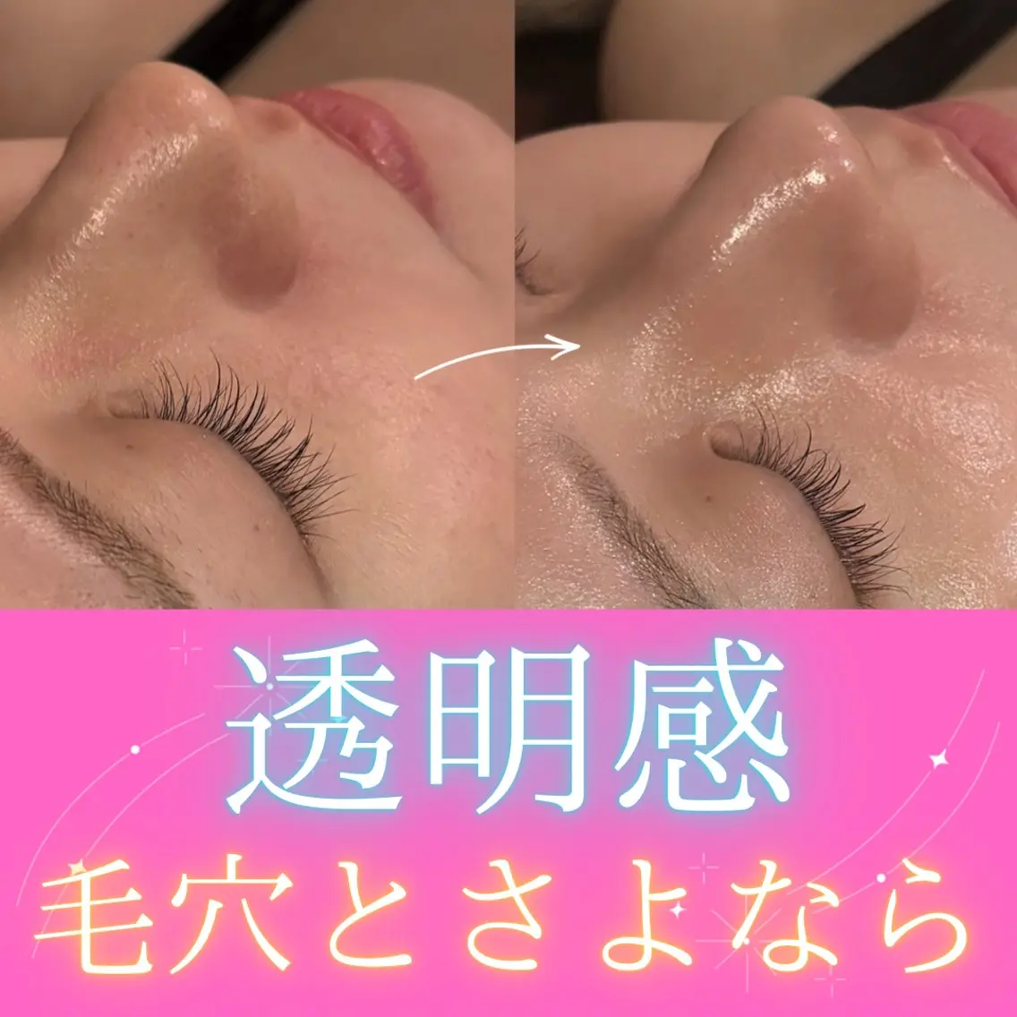 エステ リラク 痩身&美肌サロン 堀米✨のその他イメージ