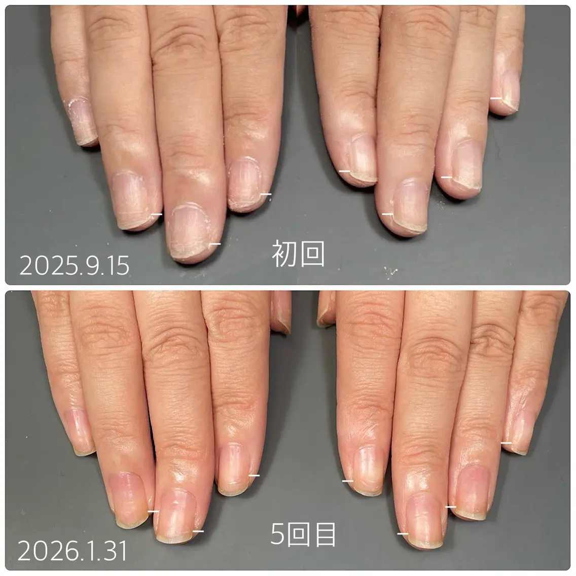 ネイル ピンク 後藤 ももえのネイルデザイン