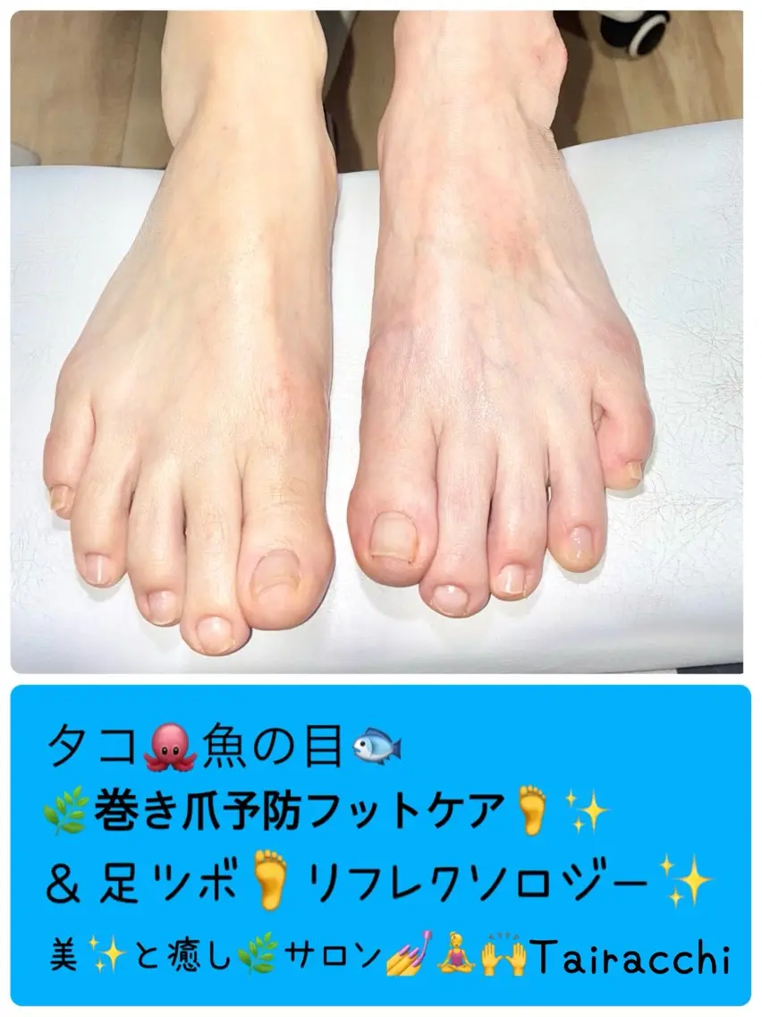 ネイル フットネイル フットネイル Tairacchi タイラッチのネイルデザイン