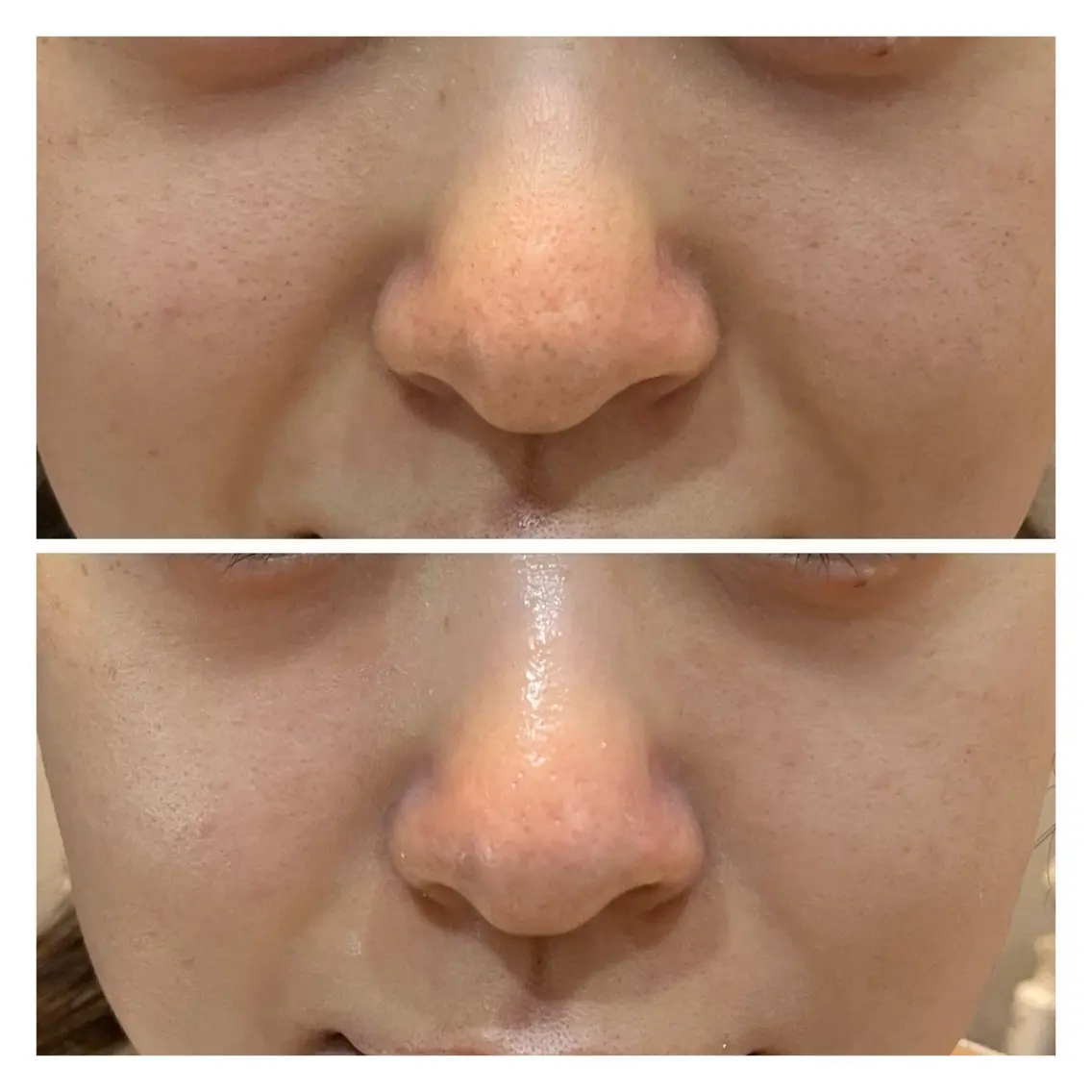 エステ Facial Salon.NANIのエステ・リラクイメージ