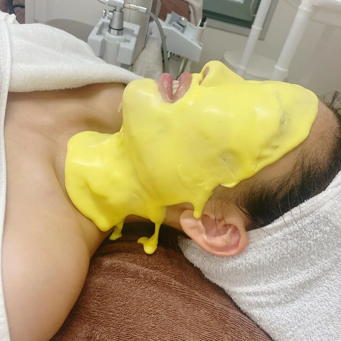 《ビタミン注入🍋くすみを飛ばし内側から白い肌へコース💛》肌荒れ予防にも効果的な人気生パック✨️限定残り3名様🍃の写真