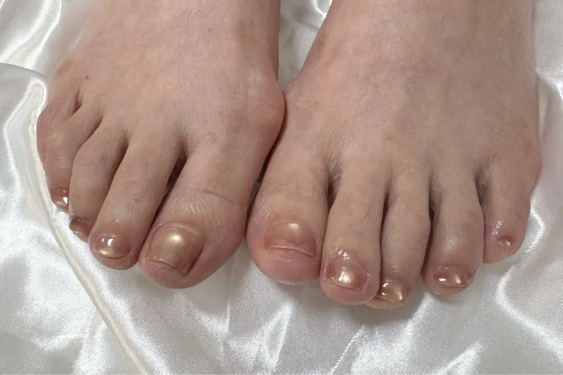 ネイル フットネイル Amule nailのネイルデザイン
