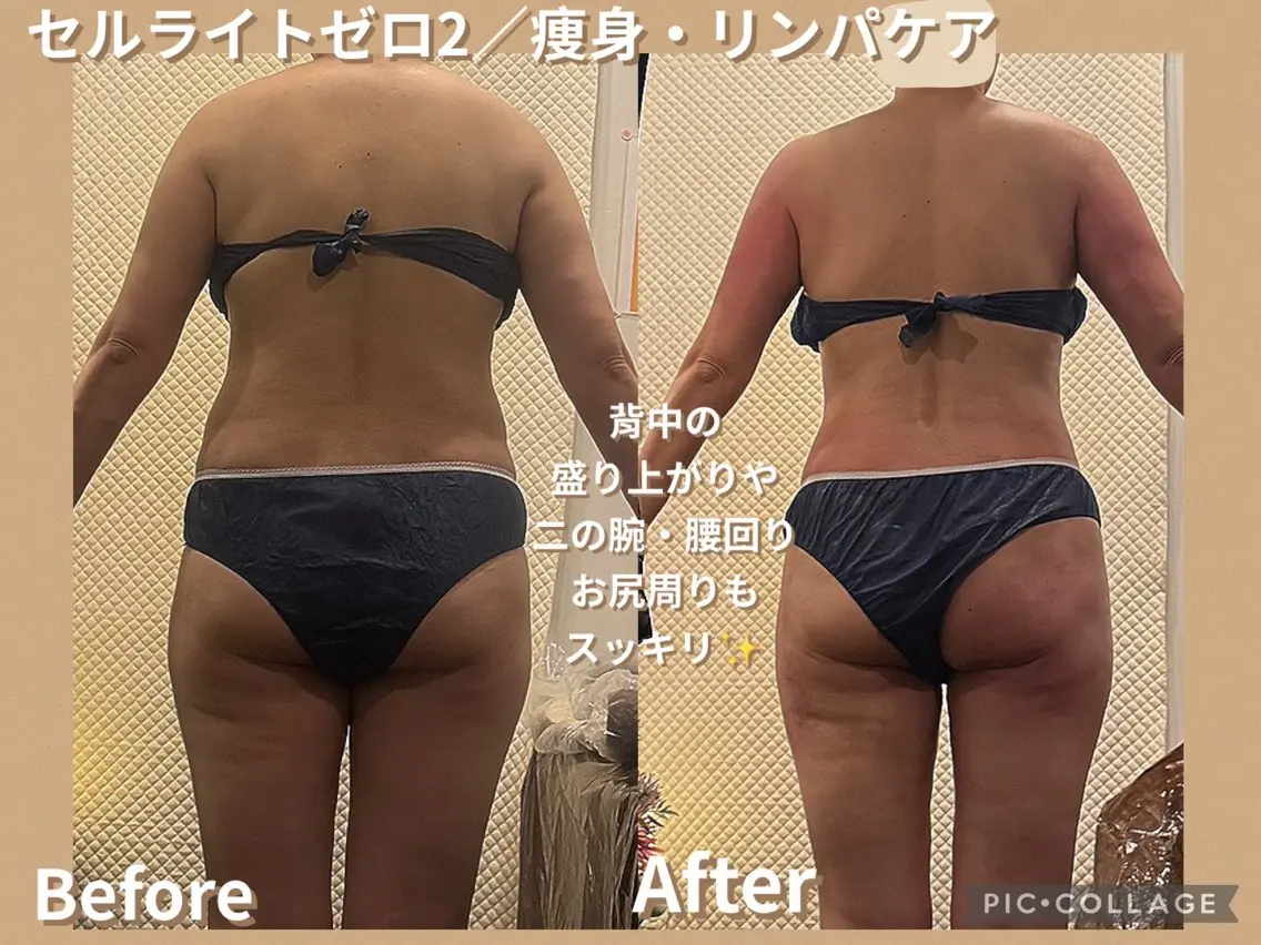 Arisa｜阪神西宮 肩こり腰痛リンパ痩身のエステ・リラクイメージ