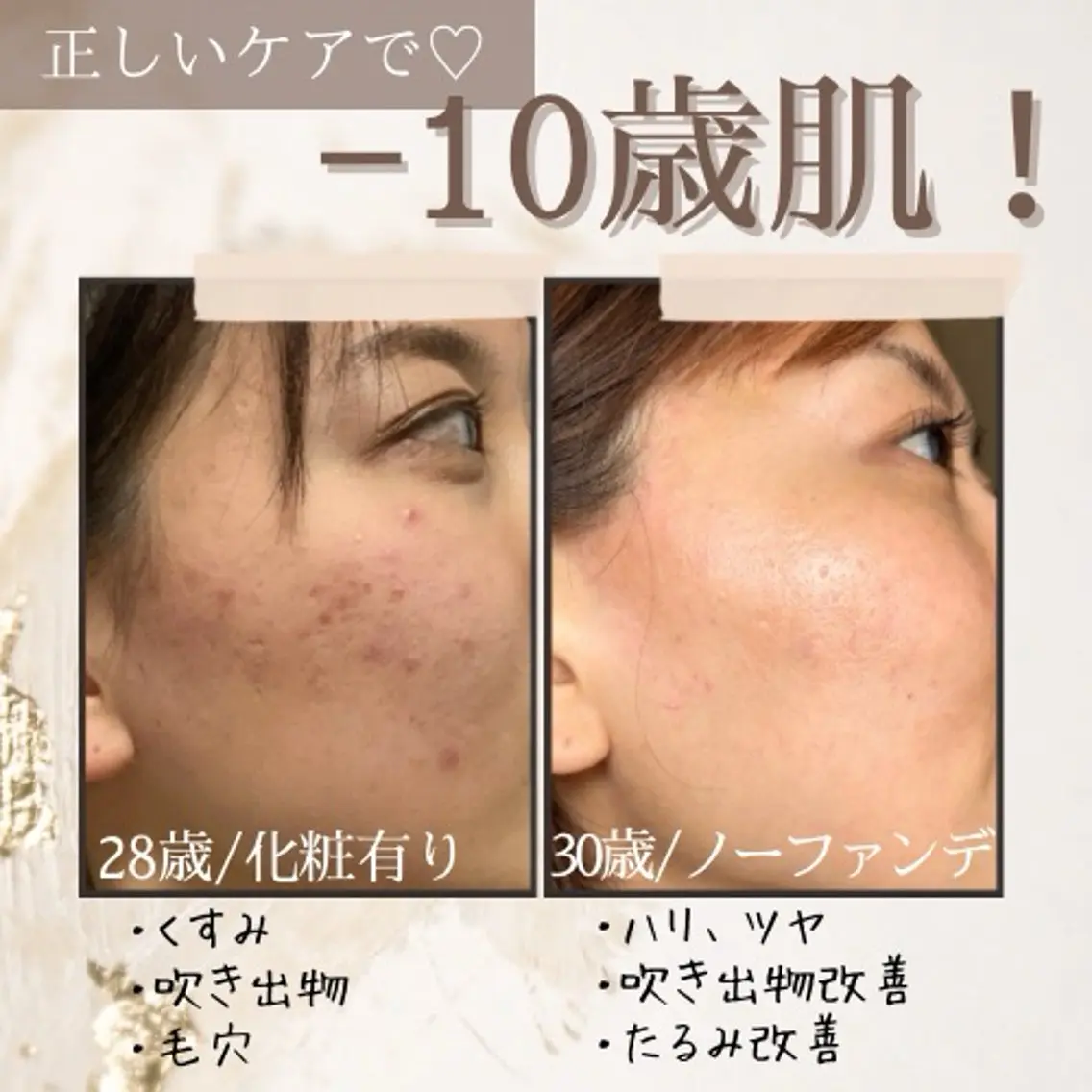 エステ リラク 《美肌･小顔》美容鍼 ＆マッサージ＊MEIのエステ・リラクイメージ